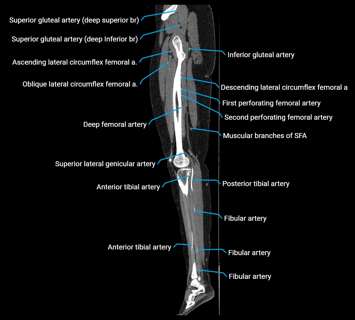 CTA lower limb sagittal cross sectional anatomy labelled image _49 (3).webp